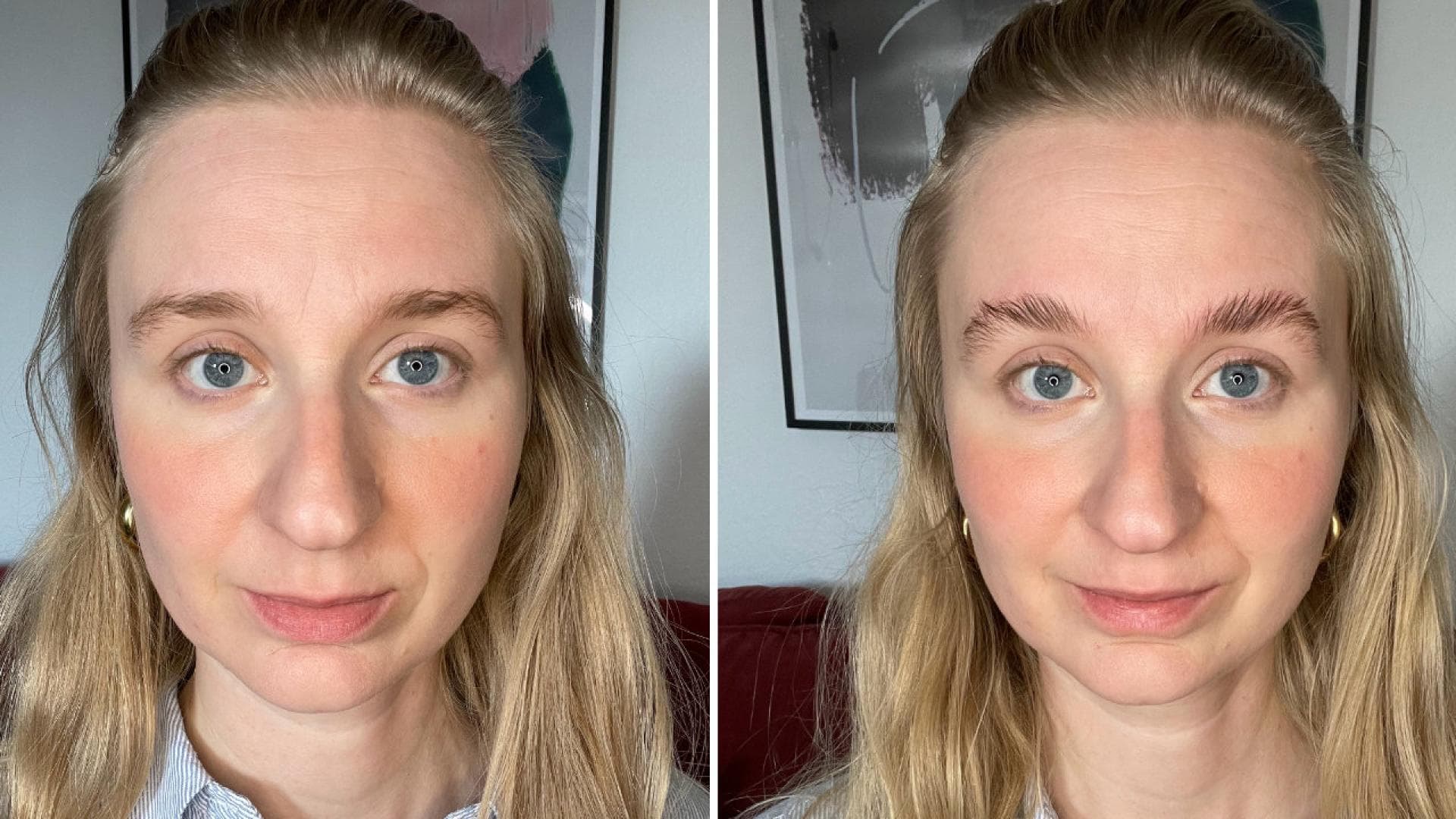 Fleeky-Brow-Lift Erfahrungen Brow Lift vorher und nachher
