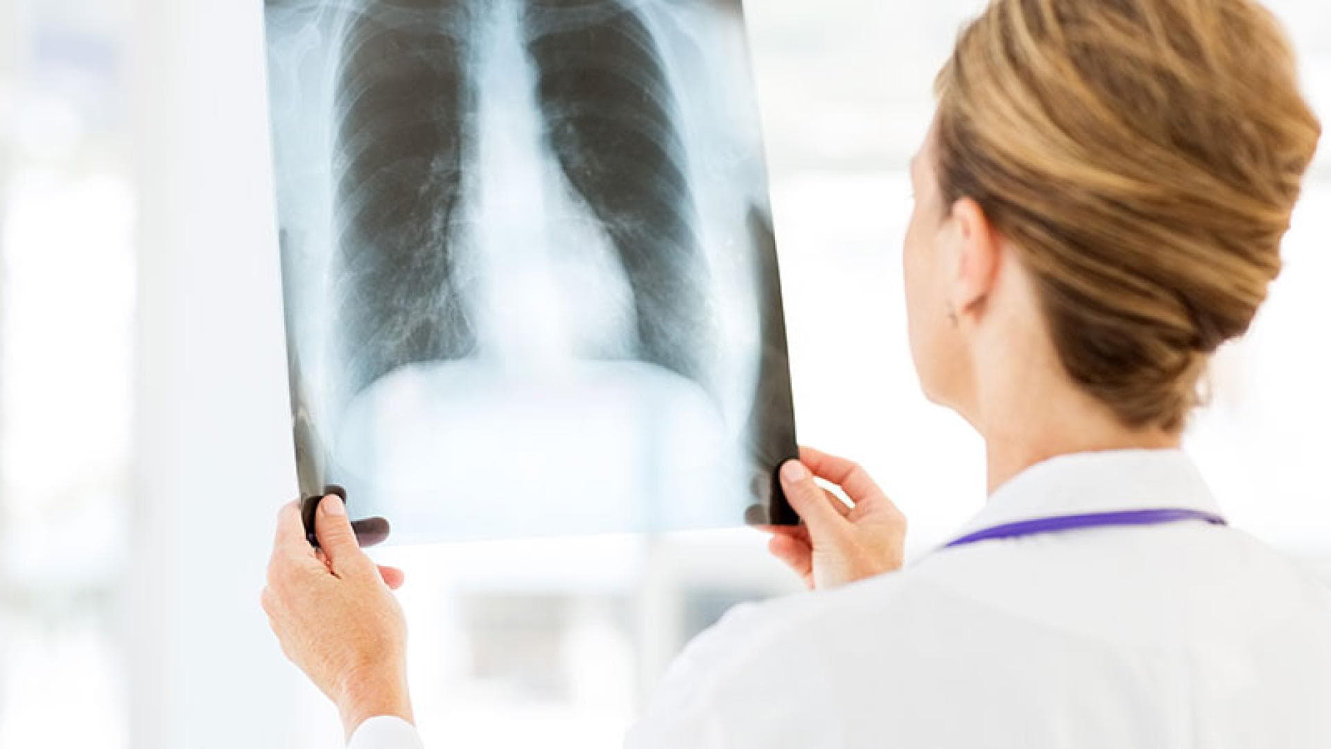 Lungenkrankheiten