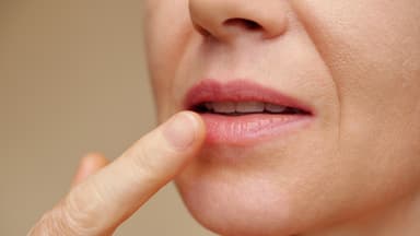 Frau mit trockenen Lippen benutzt Hausmittel