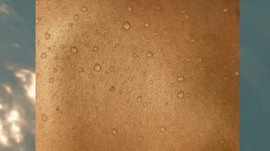 Meine Erfahrungen mit dem HydraFacial