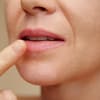 Frau mit trockenen Lippen benutzt Hausmittel