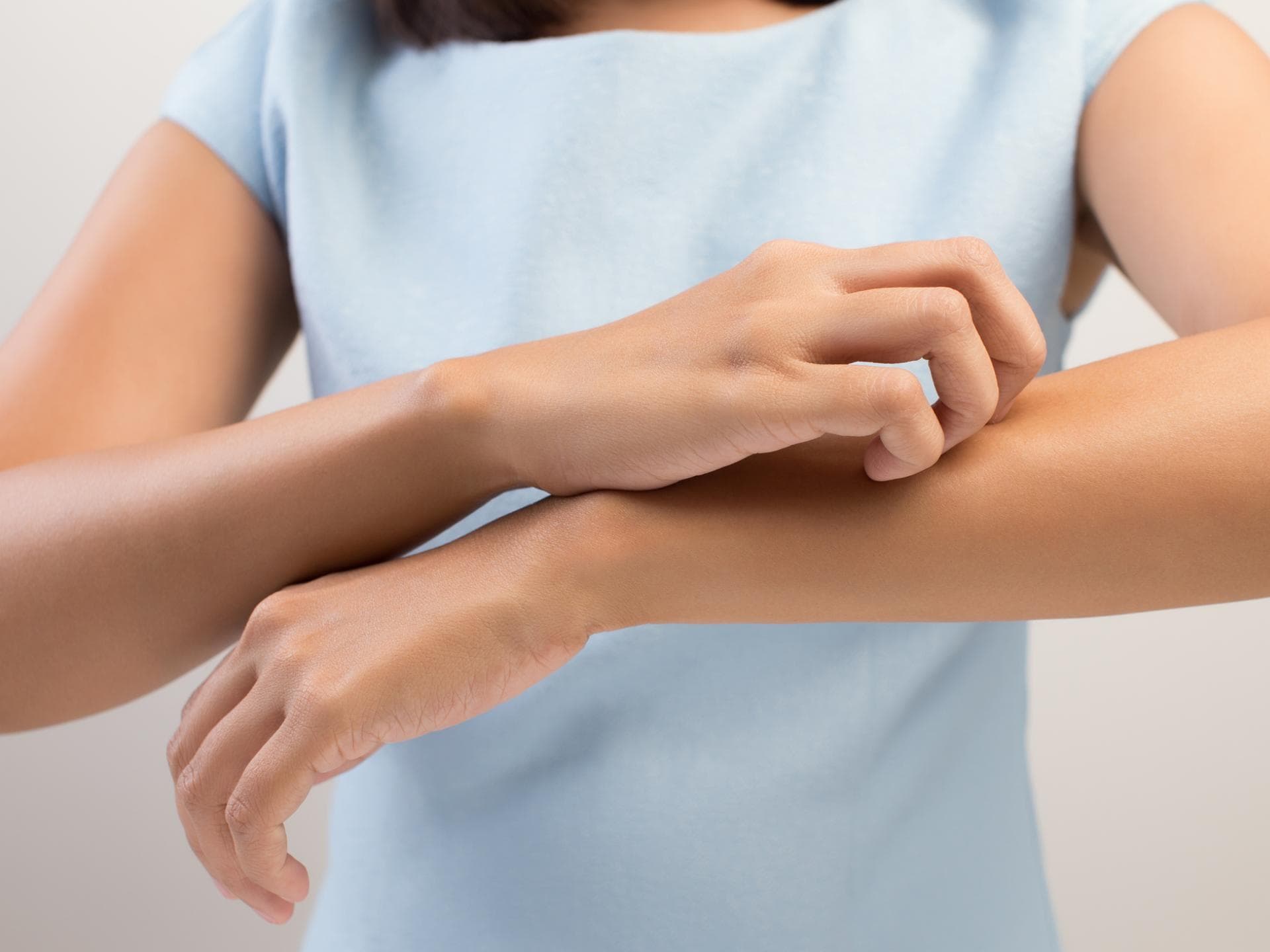 Frau kratzt sich am Arm