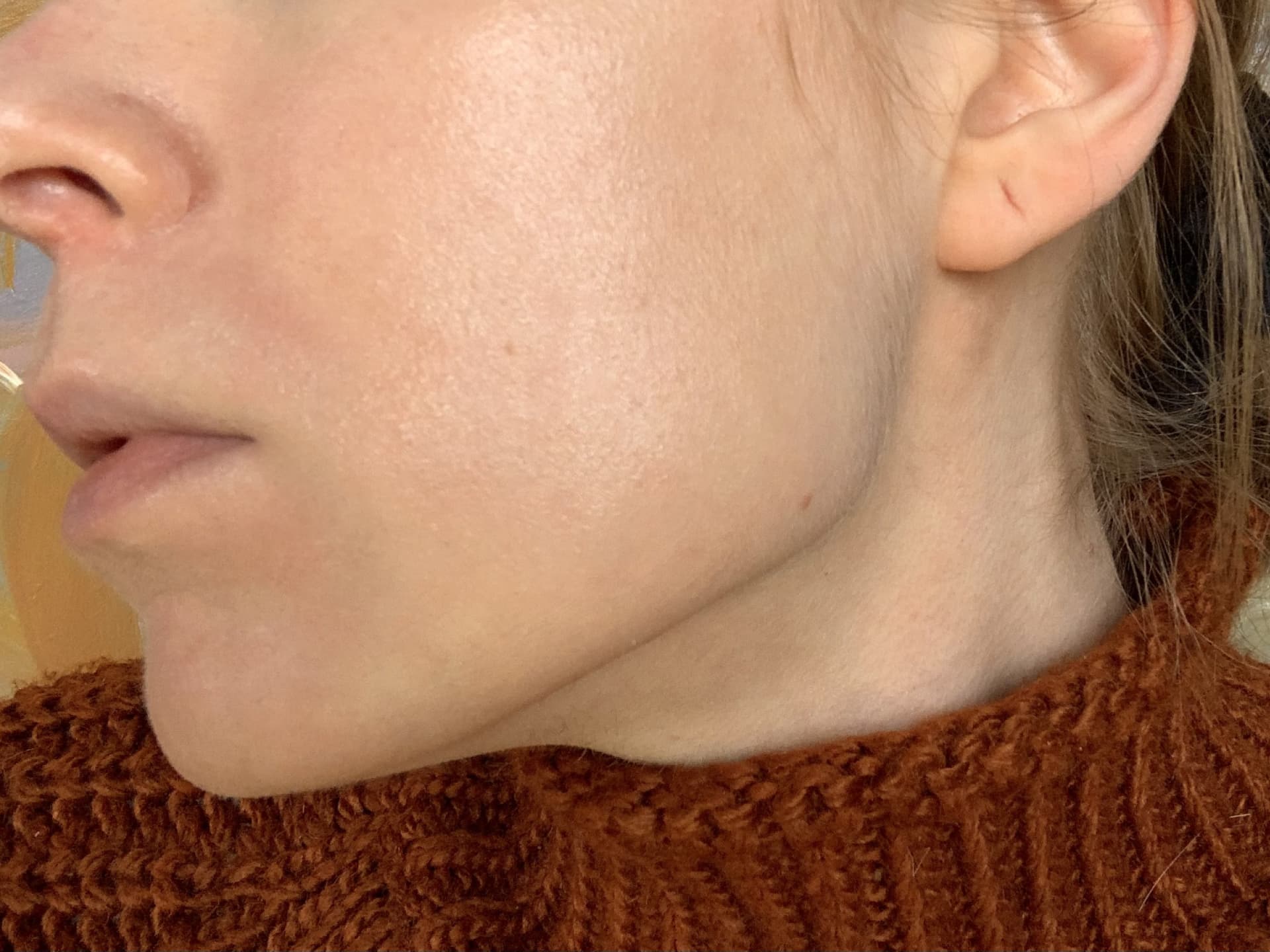 Weleda Skin Food Erfahrung Nachher im Detail