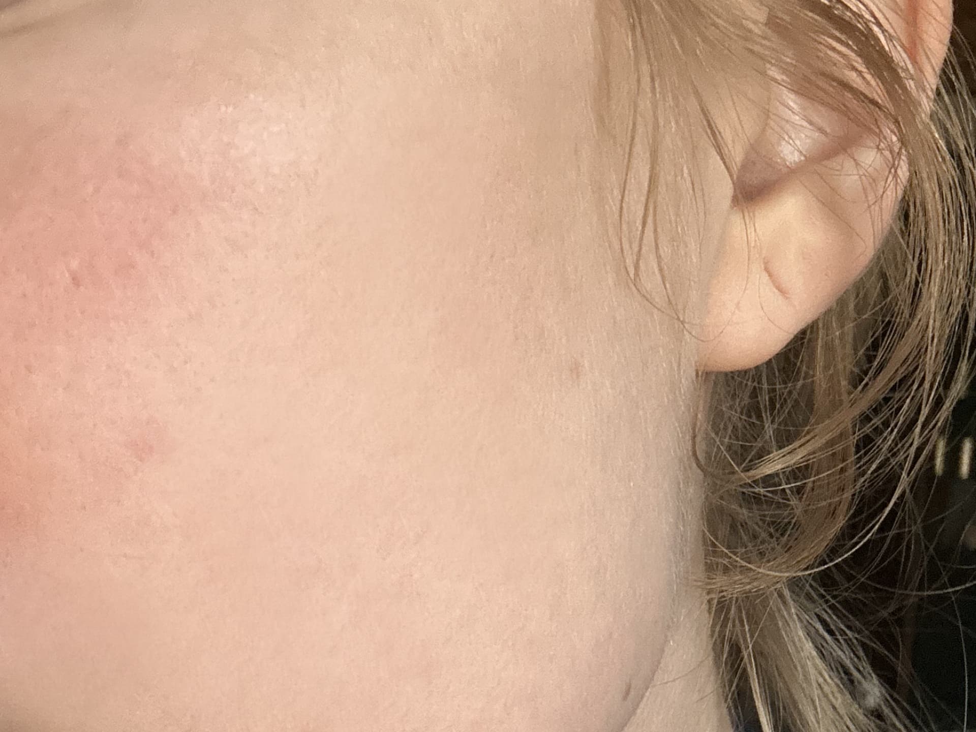 Die Retinol Intense Pflegeserie von M. Asam verursacht gerade am Anfang leichte Rötungen