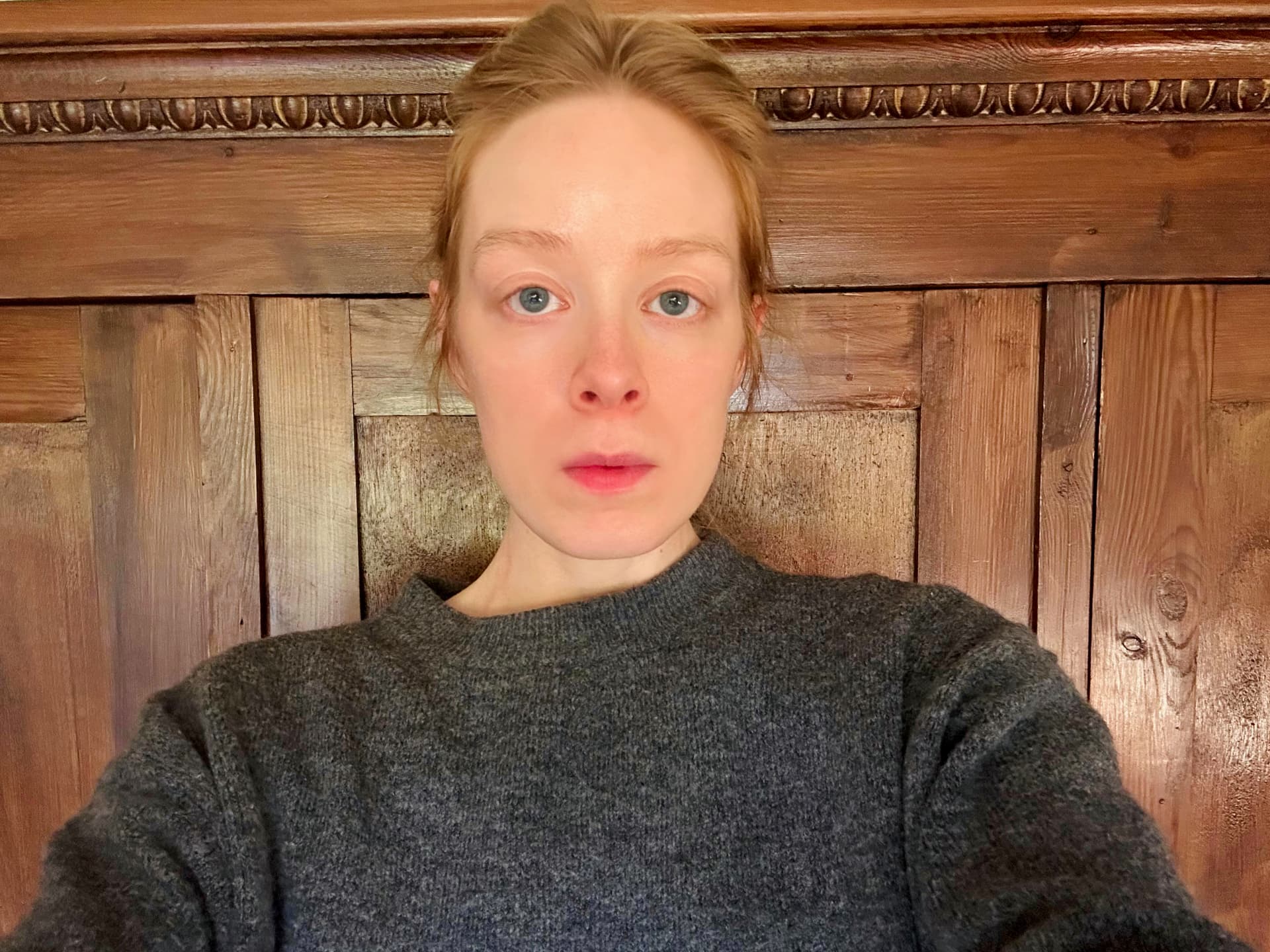 Mein Gesicht nach der 6-wöchigen Behandlung mit dem Ziip Halo