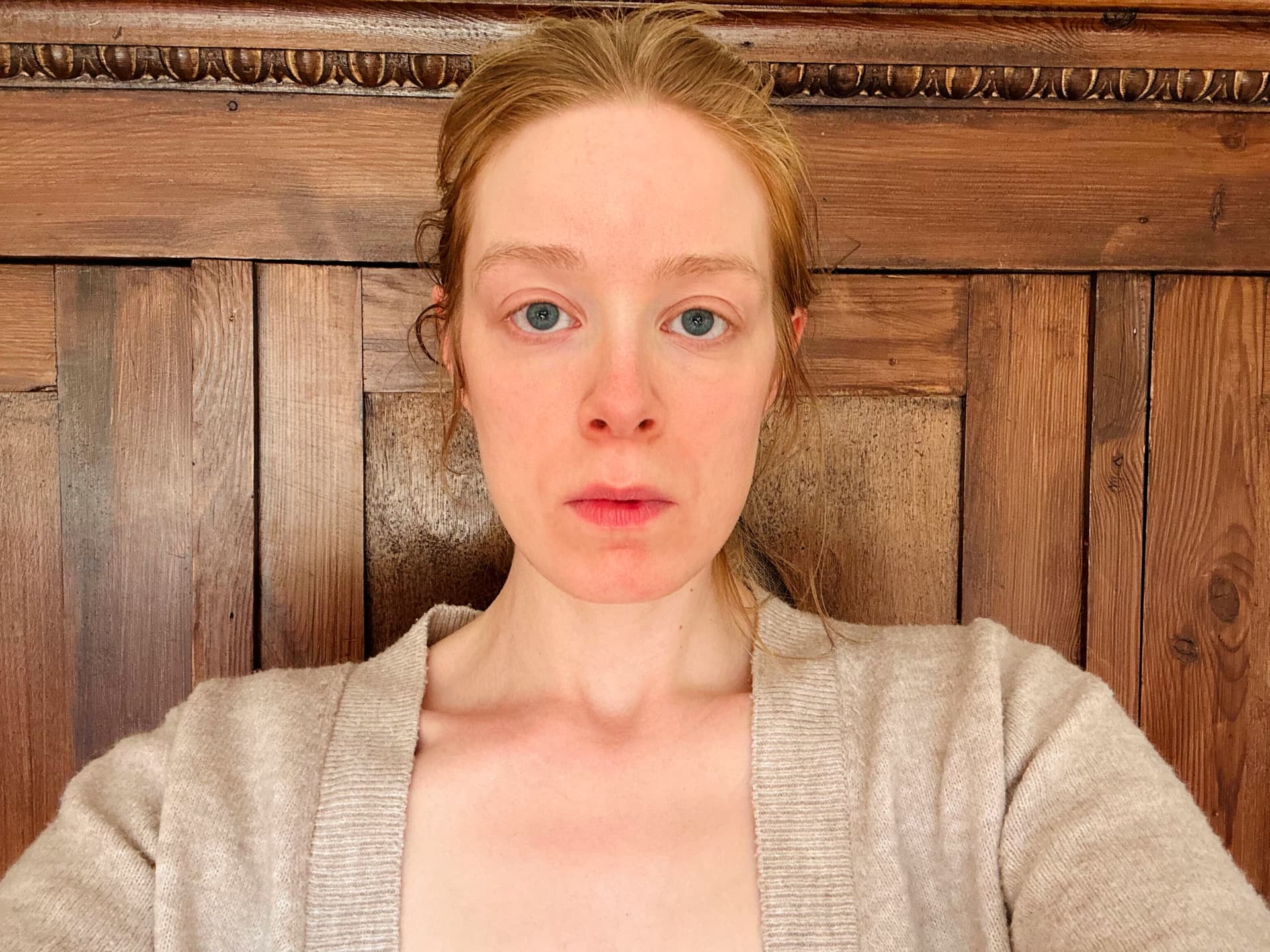 Mein Gesicht vor der Behandlung mit dem Ziip Halo