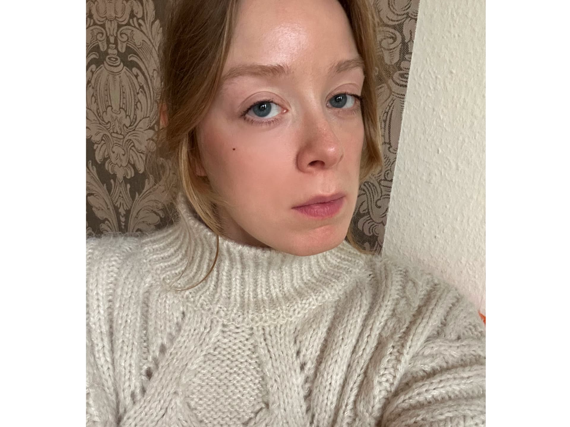 Clinique Black Honey Erfahrungen - meine Lippen vorher
