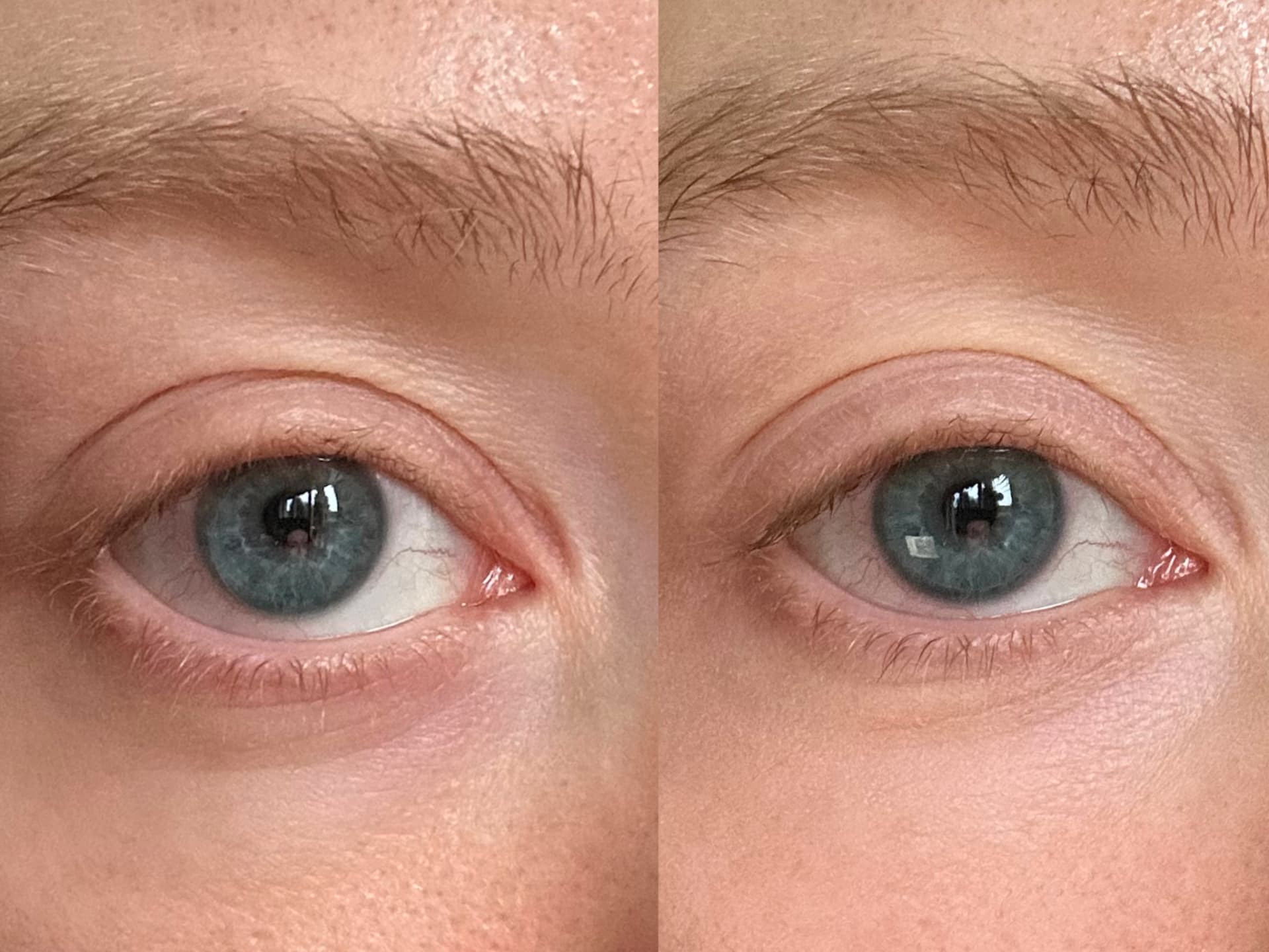 Catrice Under Eye Brightener Erfahrungen - Vorher und Nachher