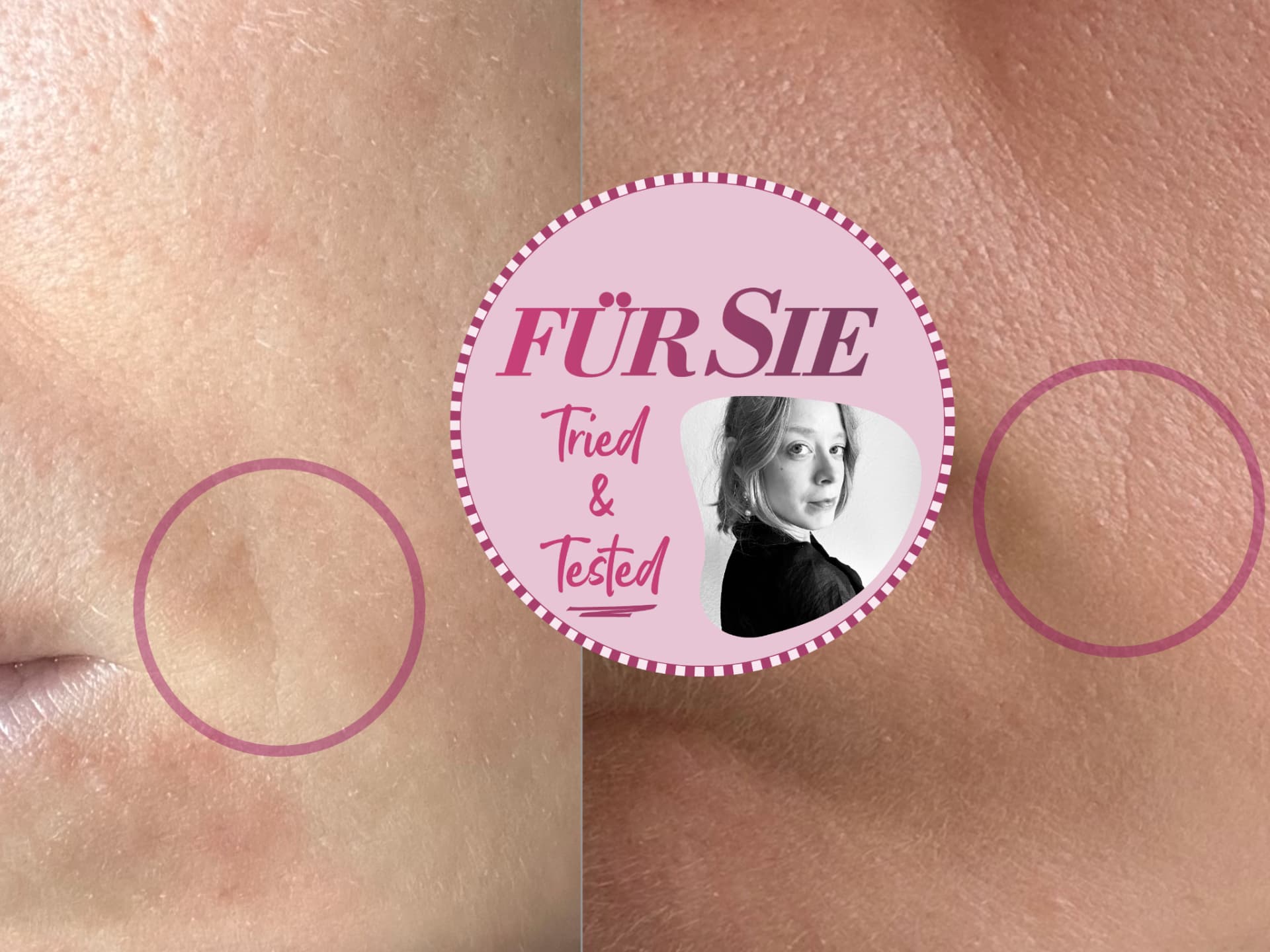 Currentbody LED-Maske 2. Generation Erfahrungen - das Gerät im großen Redaktionstest