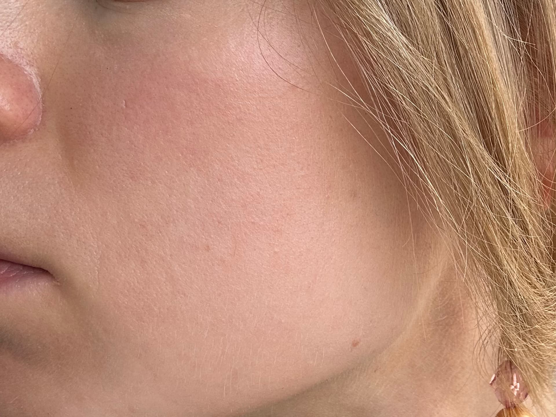 Currentbody LED-Maske Erfahrungen - Meine Haut nachher - Falten gemildert und rosiger Teint