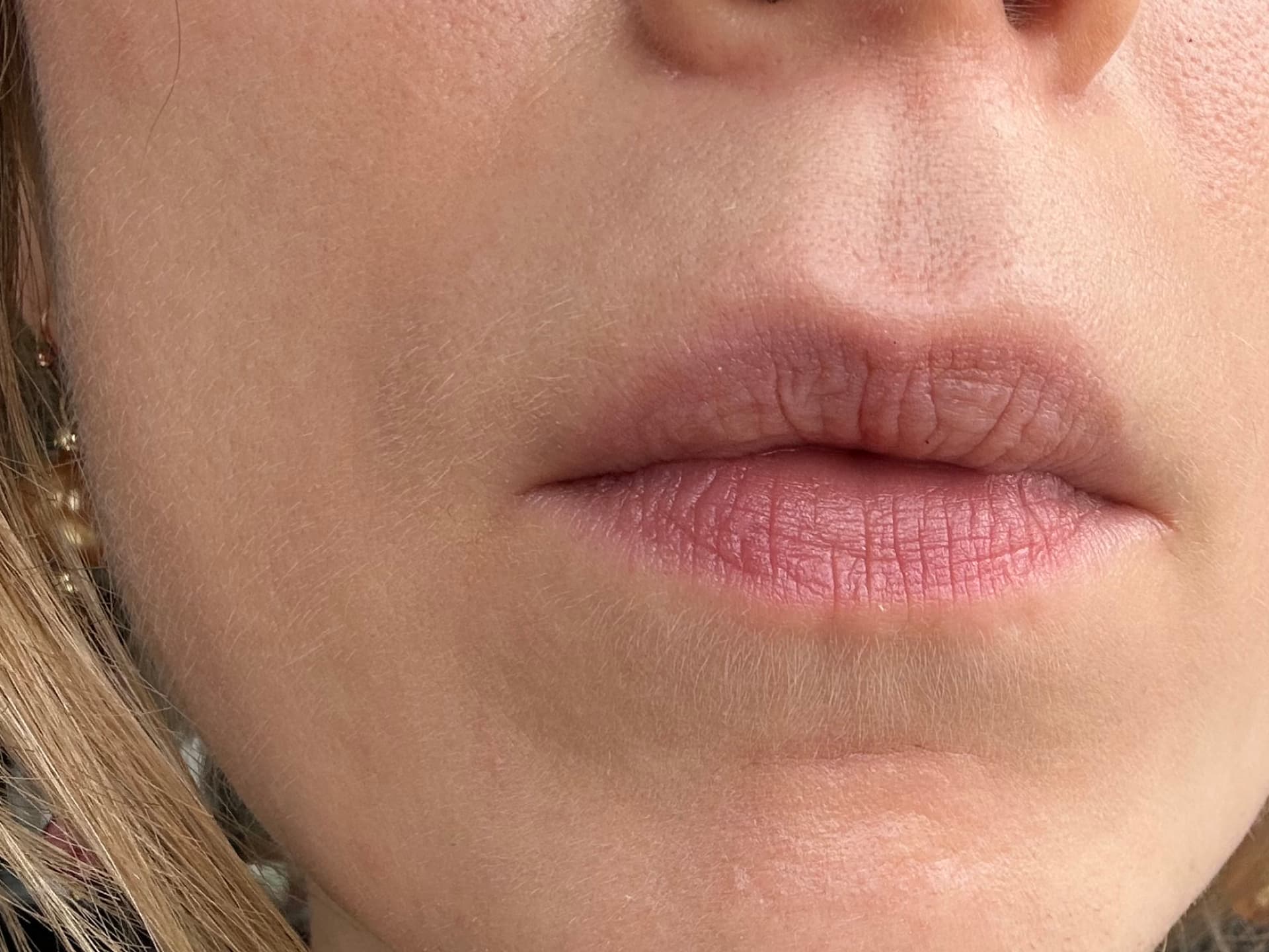 Currentbody LED-Maske Erfahrungen - meine Haut nachher