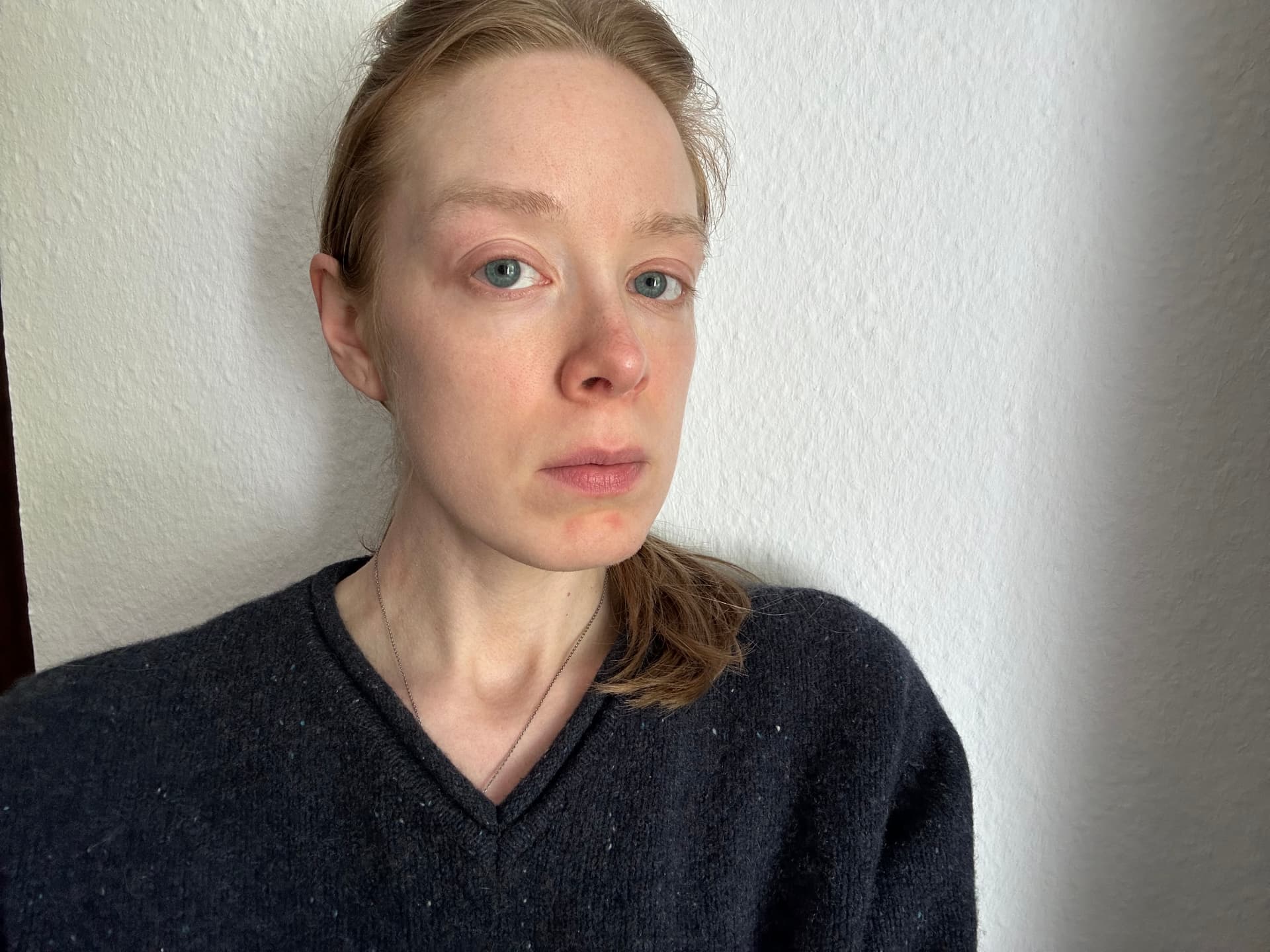 Getönte Sonnencreme Gesicht Test - Fusion Water Color LSF 50 von ISDIN vorher