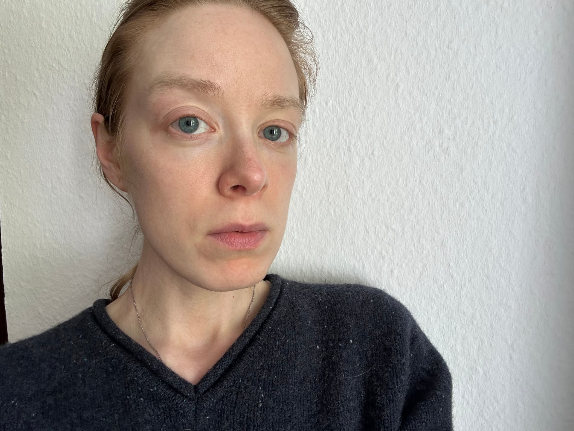Getönte Sonnencreme Gesicht Test - Anthelios Invisible Fluid von La Roche-Posay vorher