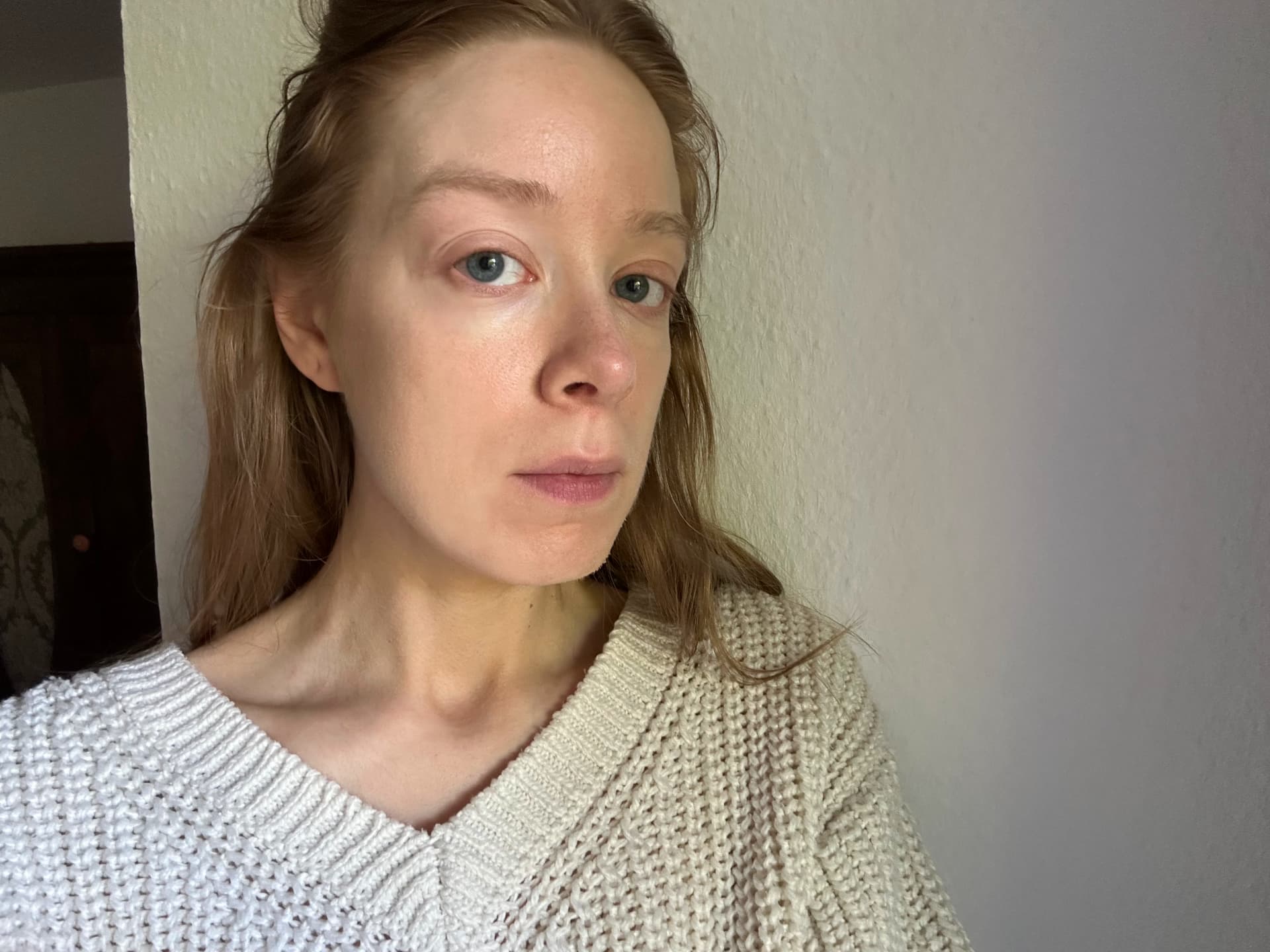 Getönte Sonnencreme Gesicht Test - Hydro Protect Sun Fluid Tinted LSF 50+ von Eucerin nachher