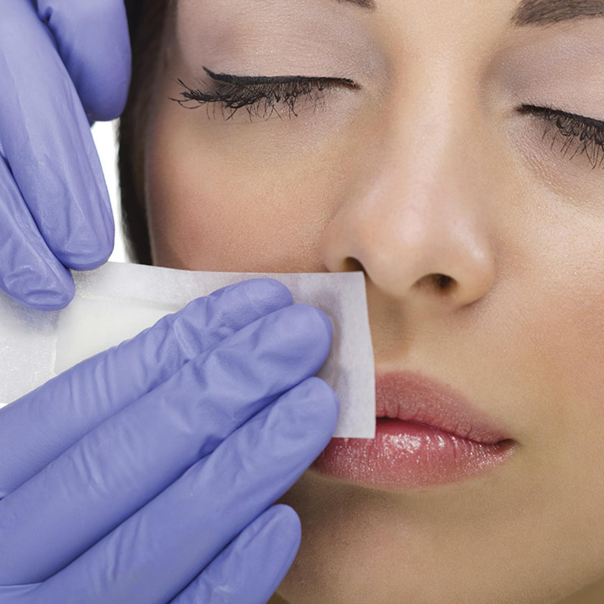 Эпиляция верхней губы. Эпиляция верхней губы. Губы естественные. Эпиляция верхней губы. Депиляция над верхней губой.